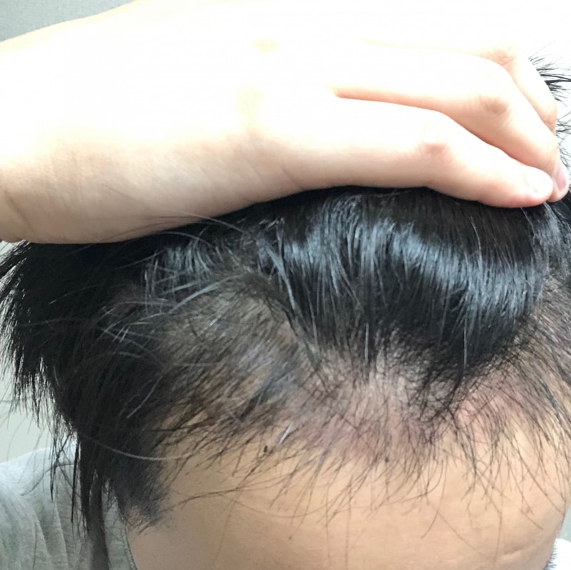다나 두달 상태 양호한듯