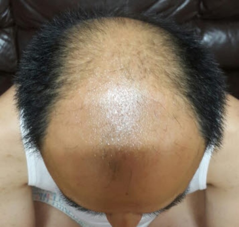 수술 전.jpg