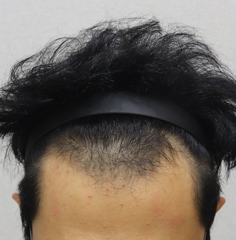 전 정면 샷.JPG