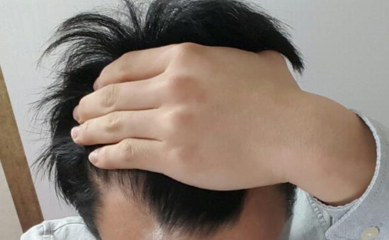 수술전1.jpg