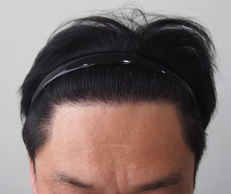 8개월 정면 병원.JPG