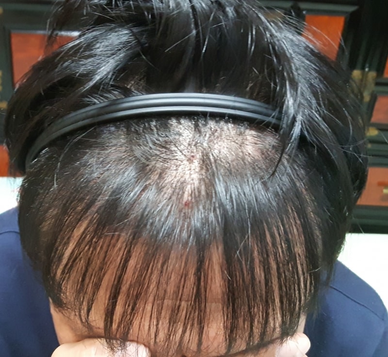 20181104_073822 밀도보강 편집.jpg