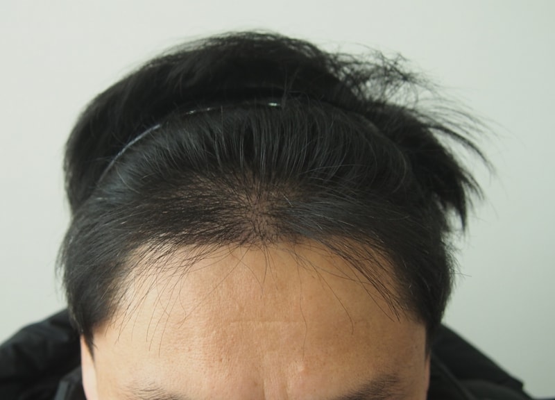 4개월차 정면.JPG