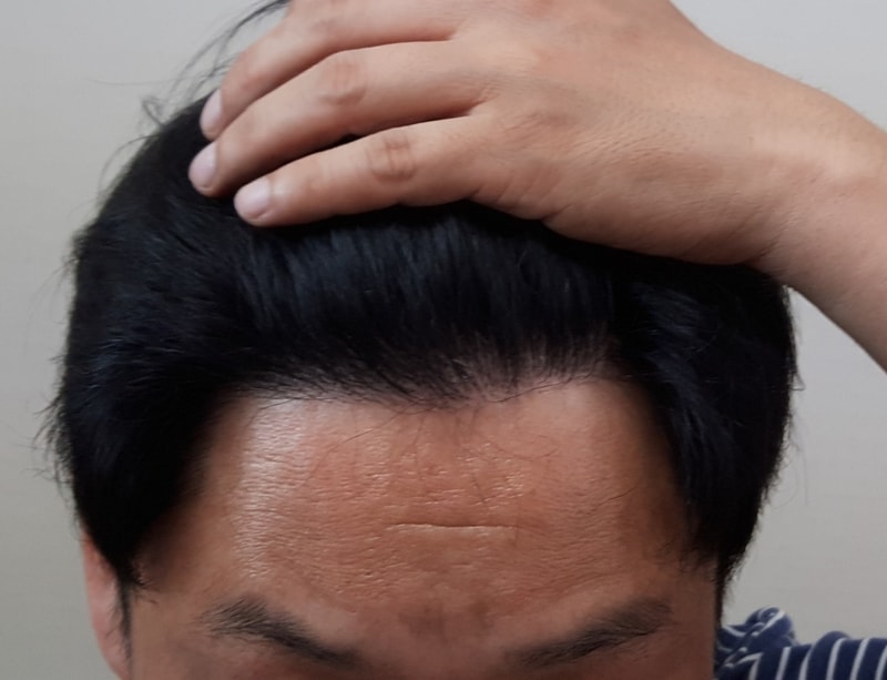8개월 정면.jpg