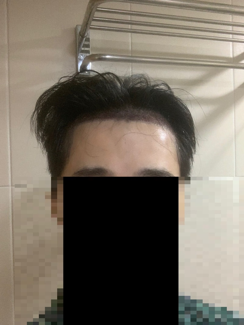 정면.jpg