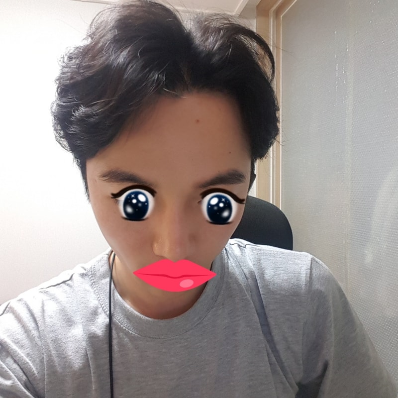 이식 후 거의 2년되가네요