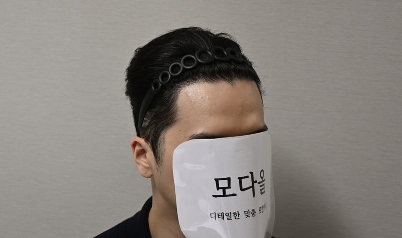 모다올 양유군원장님 180일 후기입니다