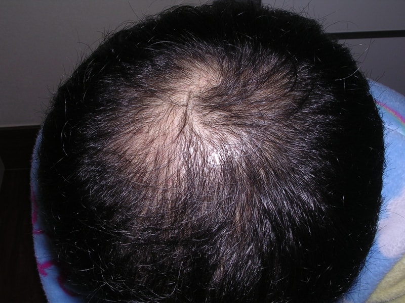 정수리.JPG