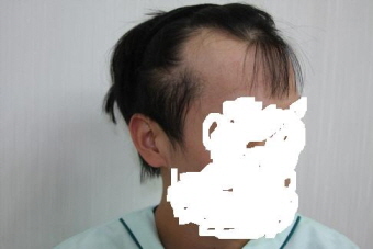 왼쪽 전 페이스.JPG