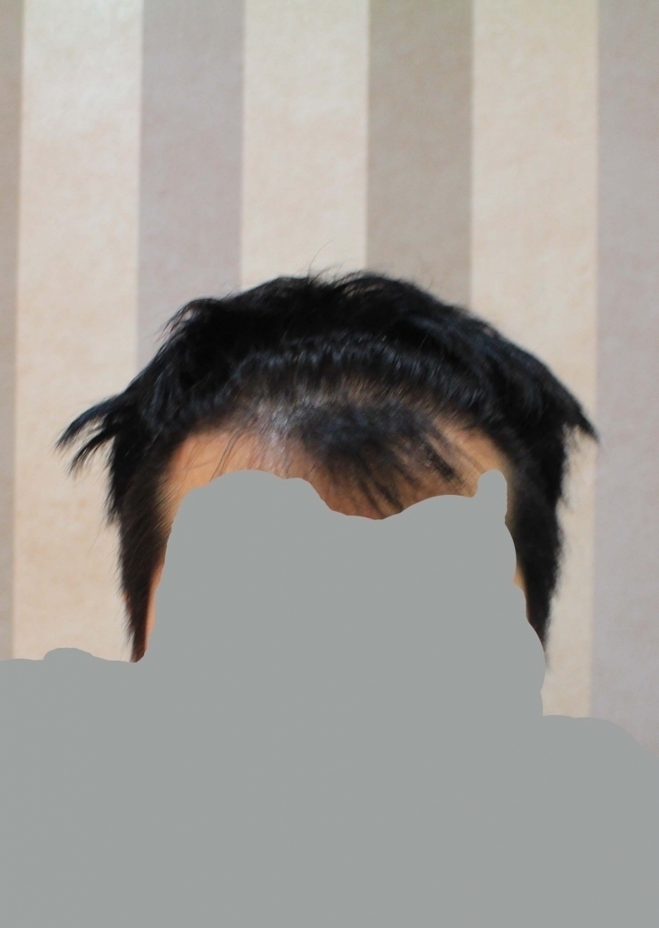 예3.jpg