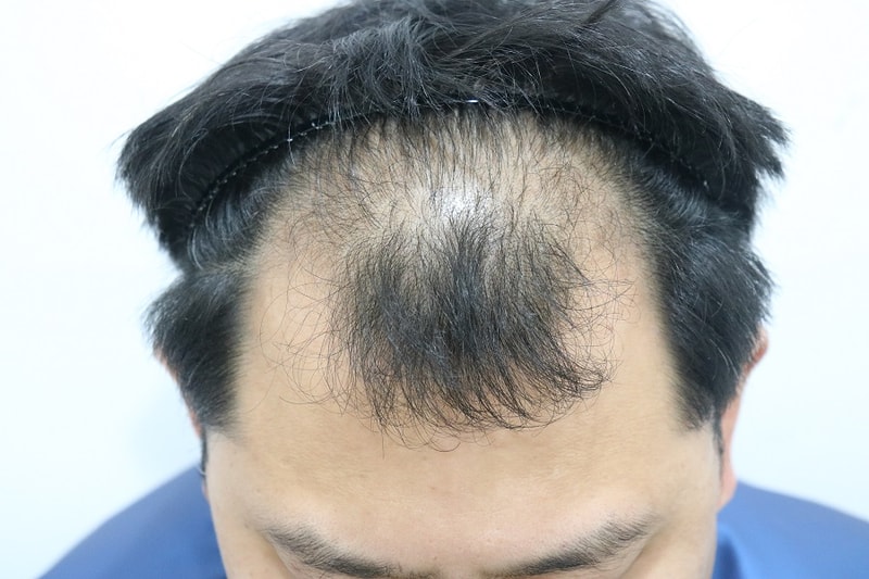 전2.jpg