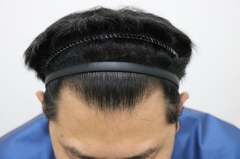 후2.jpg
