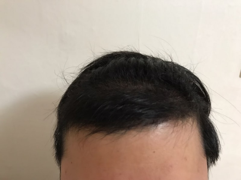5개월1.jpg