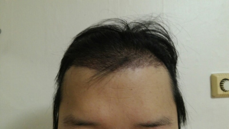 1개월2.jpg