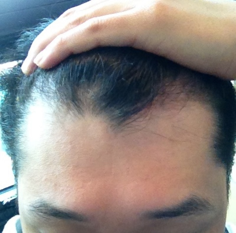 4개월차 (3).JPG