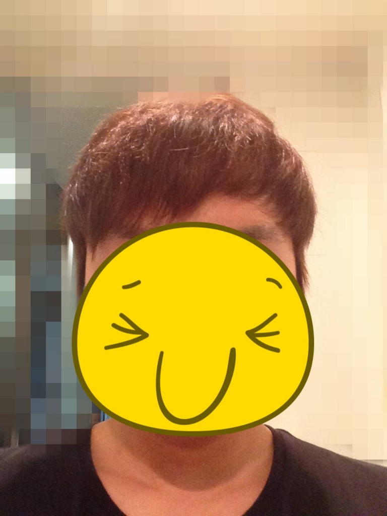 6.딱지제거 후 머리 내림.JPG