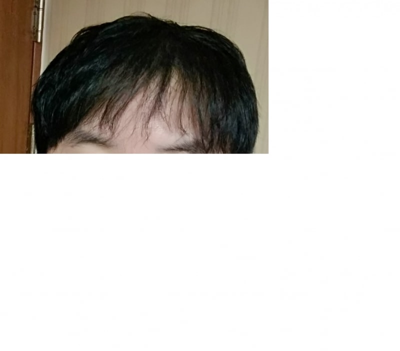 모빈치.png