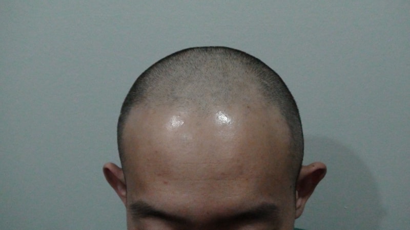 머리밀고.JPG