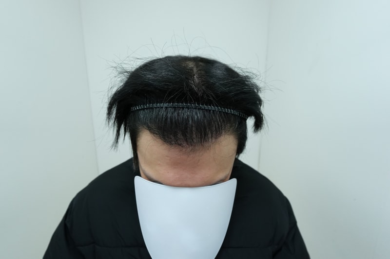 재수술. 라인.jpeg