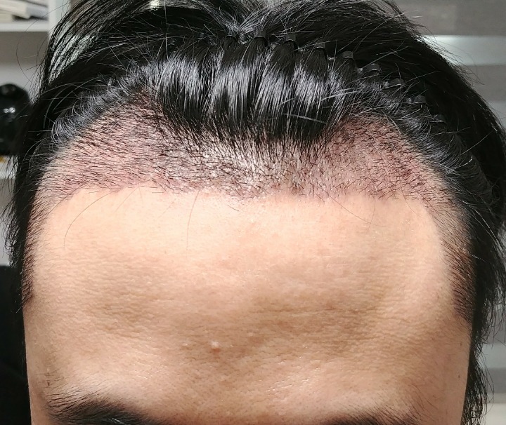 14일차(샴푸후 사진).jpg