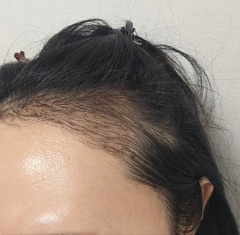 권예진_왼_후.jpg