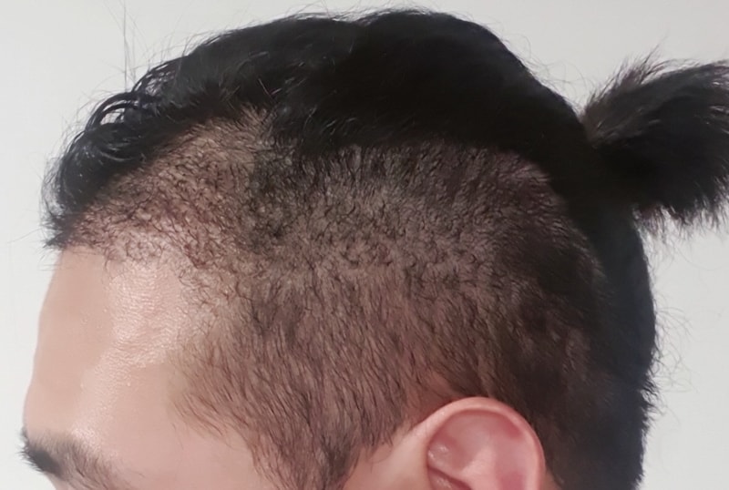 꾸미기서정주_왼쪽_후.jpg