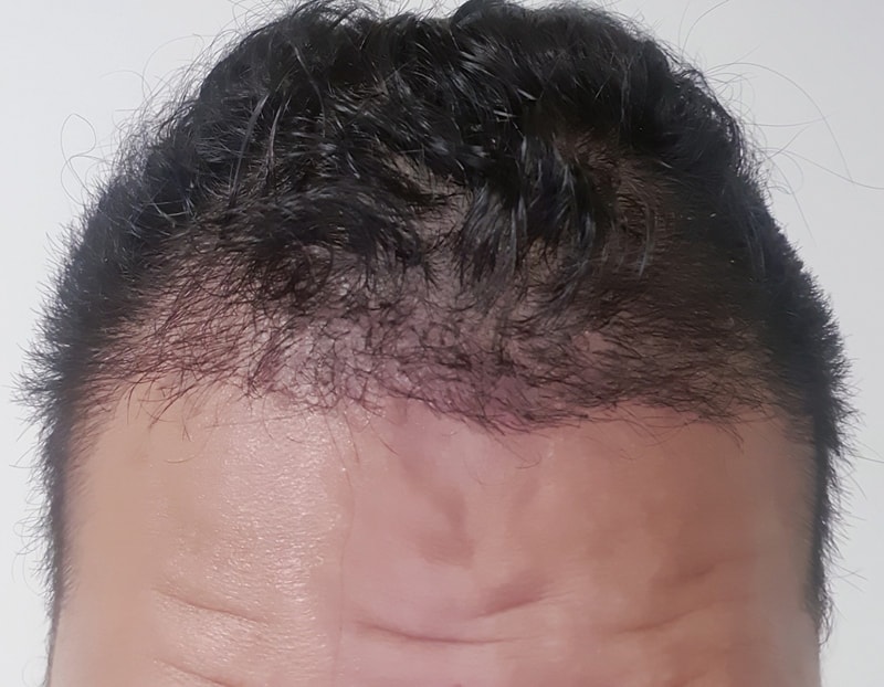 꾸미기서정주_정면_후.jpg