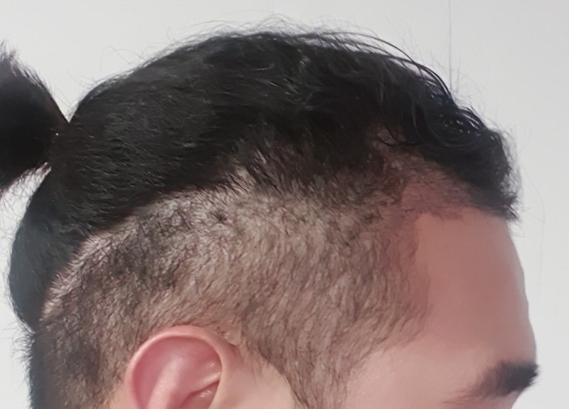 꾸미기서정주_오른쪽_후.jpg