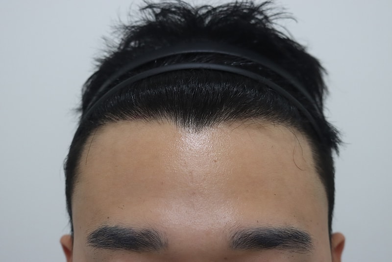 드디어 9개월 지났습니다