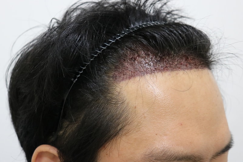 수술 후 2.jpg