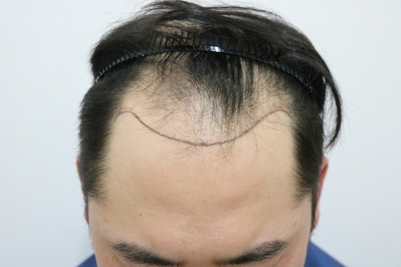 안녕하세요 오랜만에 대다모에 후기남기러왔습니다