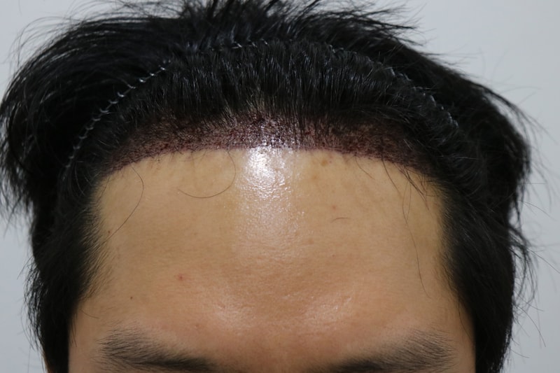 수술 후 1.jpg