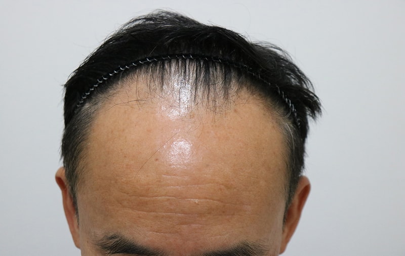 4000모 일년지났습니다.