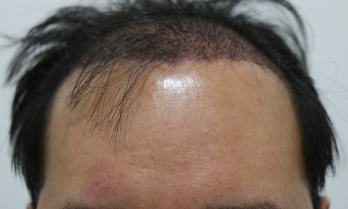 다음날.jpg
