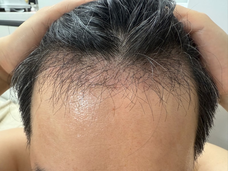 2 months review. (COVID-19)