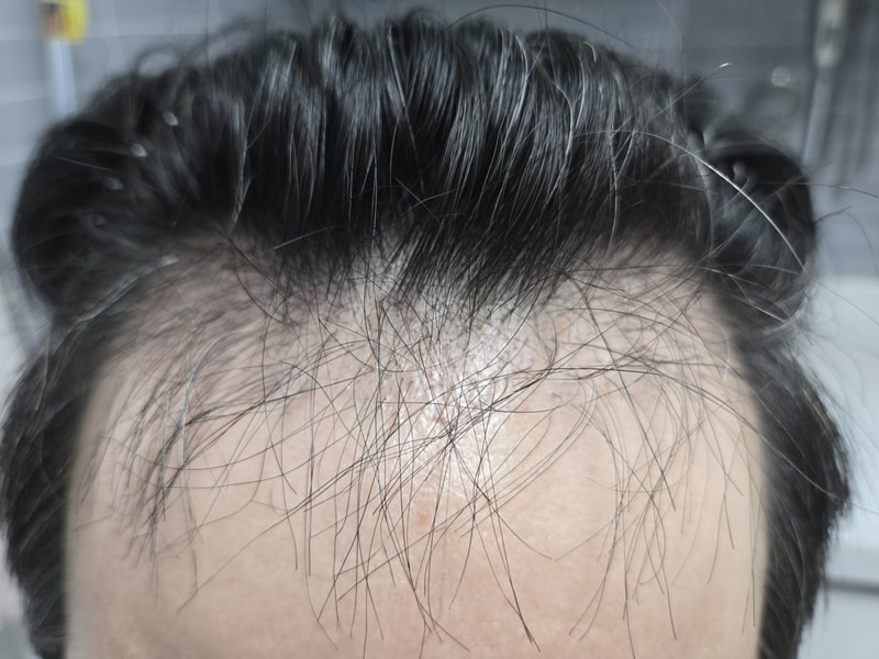 3 months, finally the peak of the dark age?! It looks more empty than last month.crying
