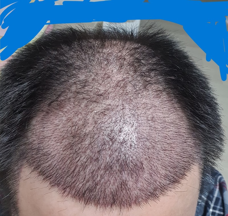 김대우 원장님께 5000모 받았어요