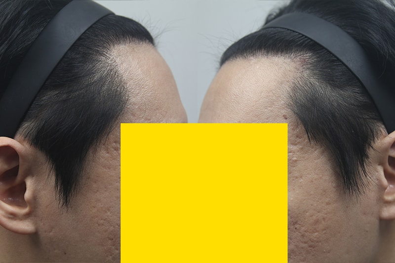 1년차2.jpg
