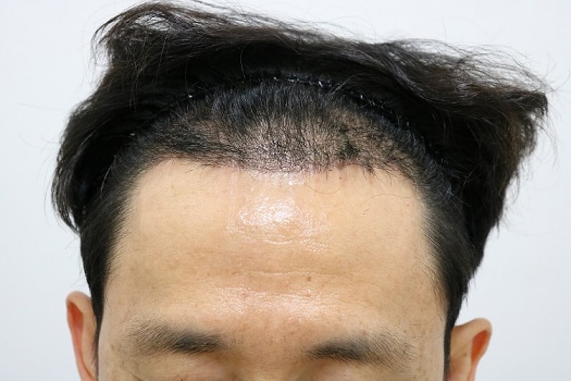 후9.jpg