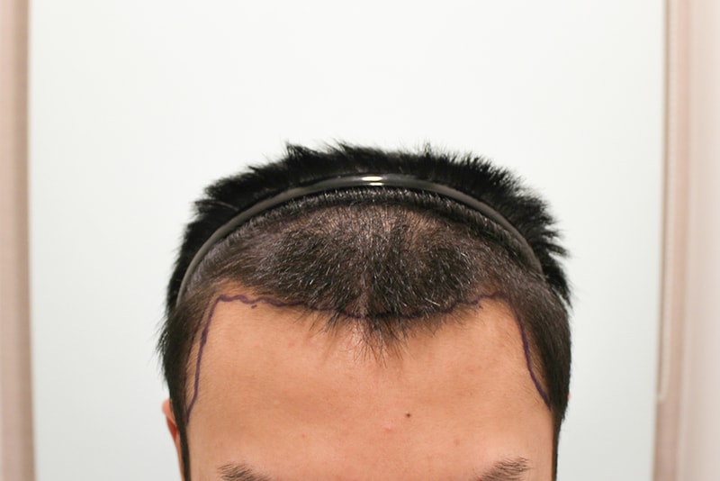 1.JPG