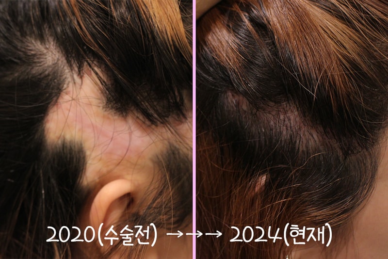 1. 수술전 → 최종.jpg