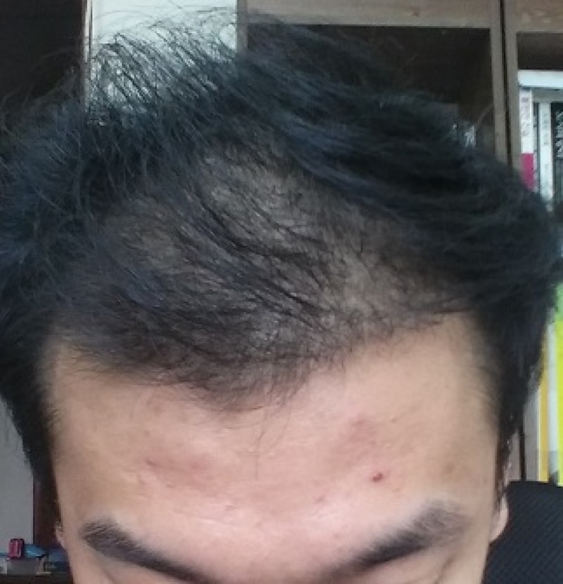 01.수술 98일차(1).jpg