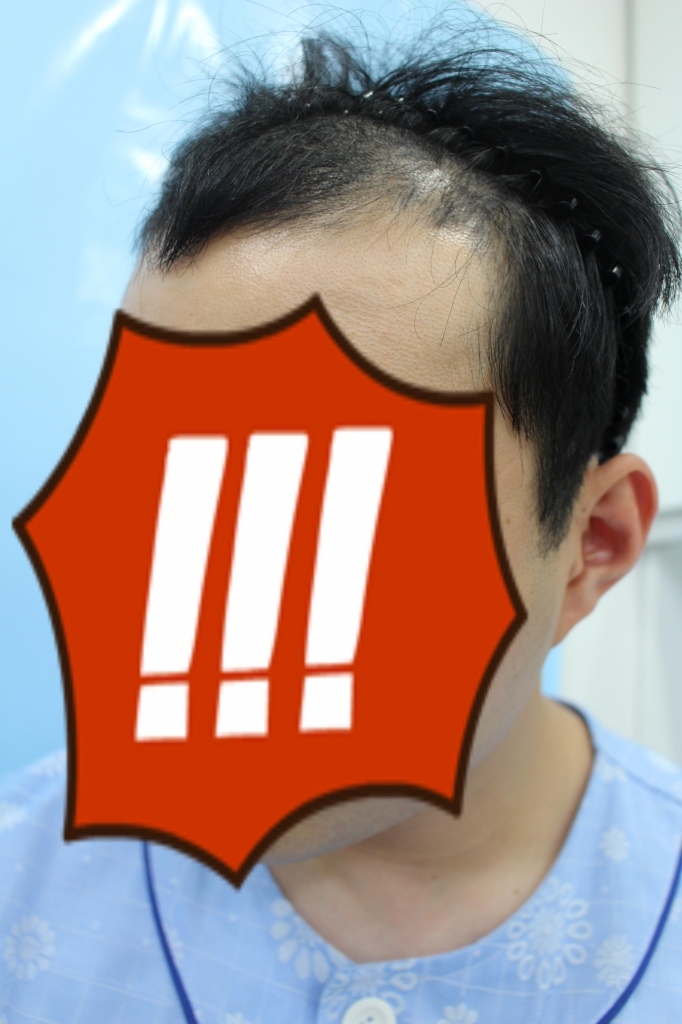 한나이브 3251 이식했어여 전사진 ㅎ
