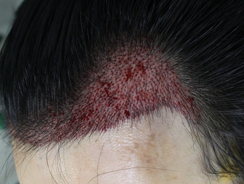 수술후2.jpg