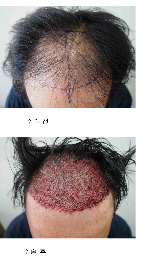 모재성 끝 사본.jpg