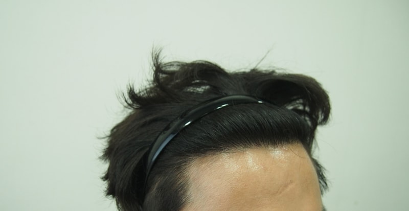 1년차 우측.jpg