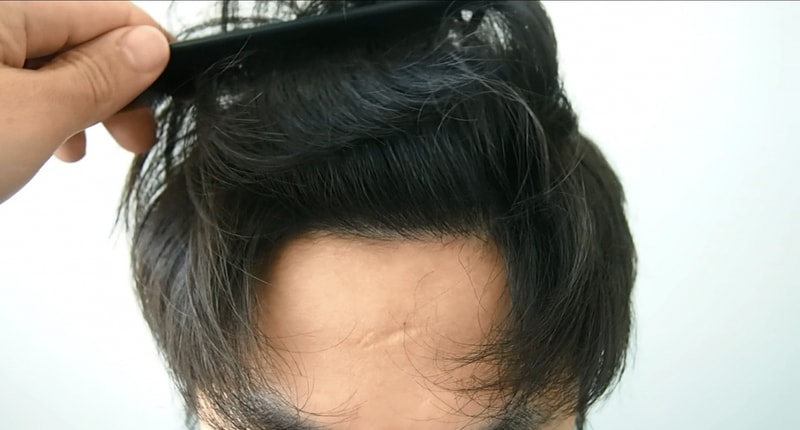 8개월차 정면.jpg