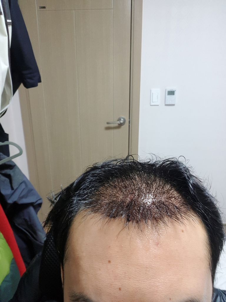 [회전]20190317_5일차.jpg