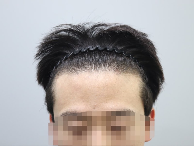 4개월 정면.jpg