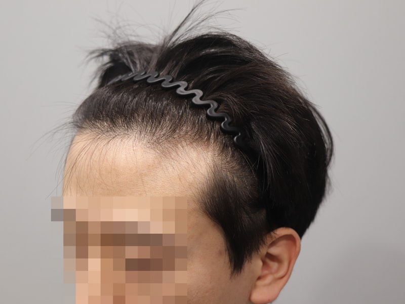 수술전1.JPG